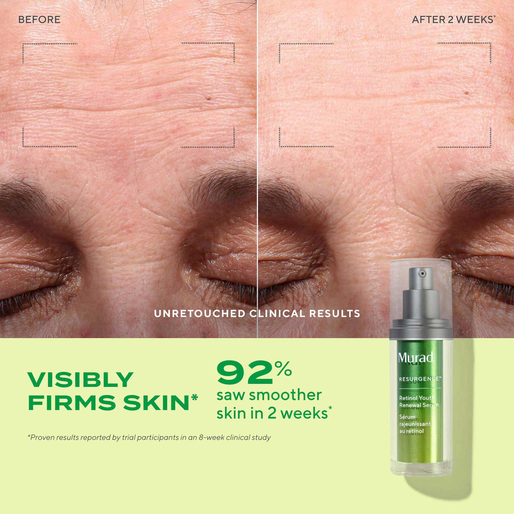 Murad Top 3 Derm-Recommended Actives Trial Kit – Ess-C Cleanser, Retinol Serum, Hydro Dynamic Moisturizer
