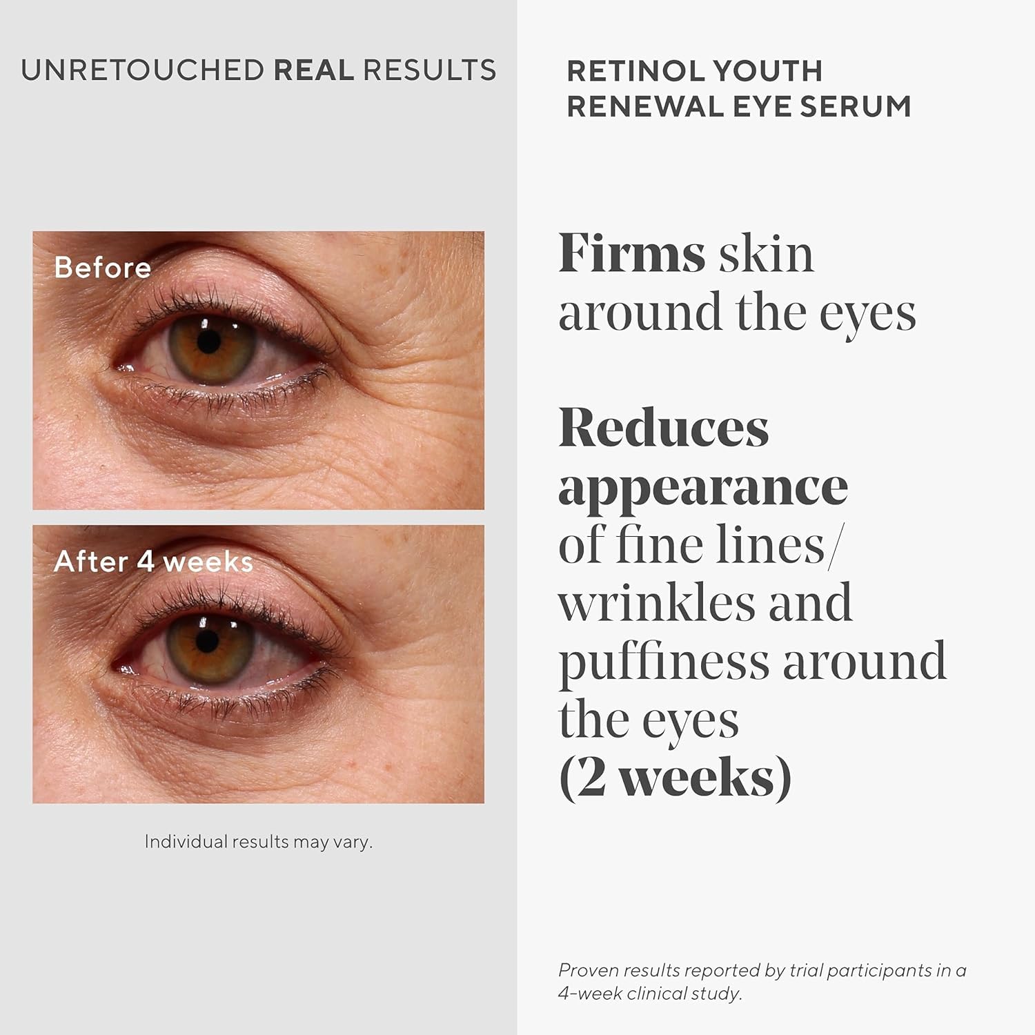 Murad Youth Renewal Retinol Trial Kit – 3-Piece Anti-Aging Set