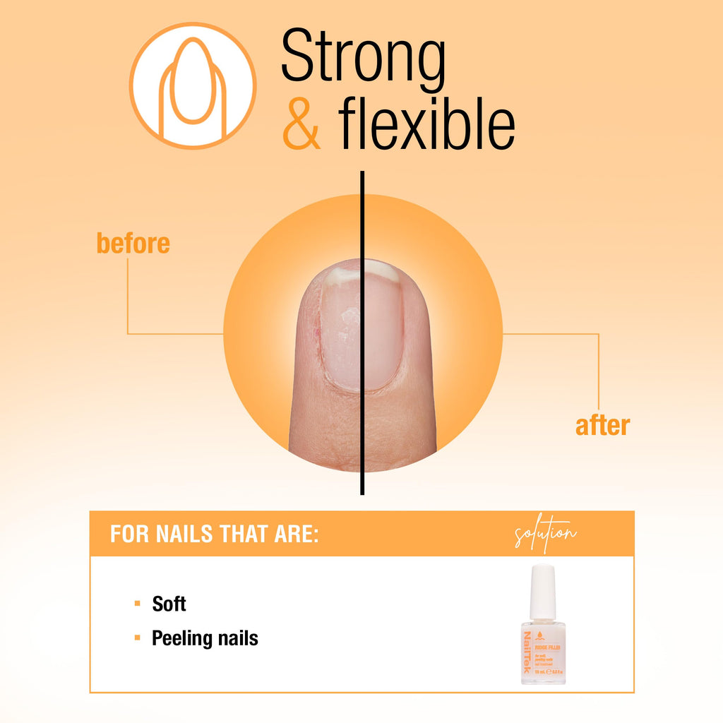 Nail Tek Ridge Filler Formula 2 – Clear Ridge Filler Base Coat for Soft, Peeling Nails