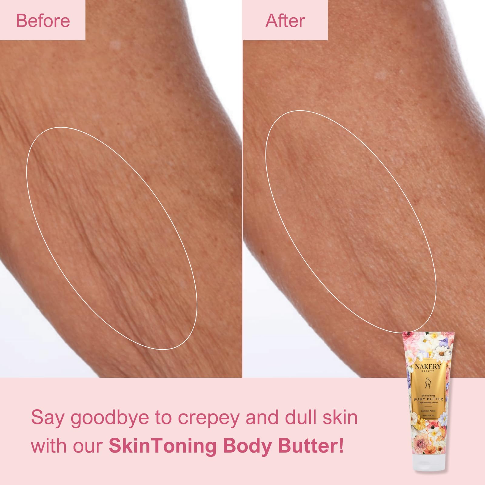Nakery Skin Toning Body Butter – Peptide Firming Lotion for Crepey & Sagging Skin