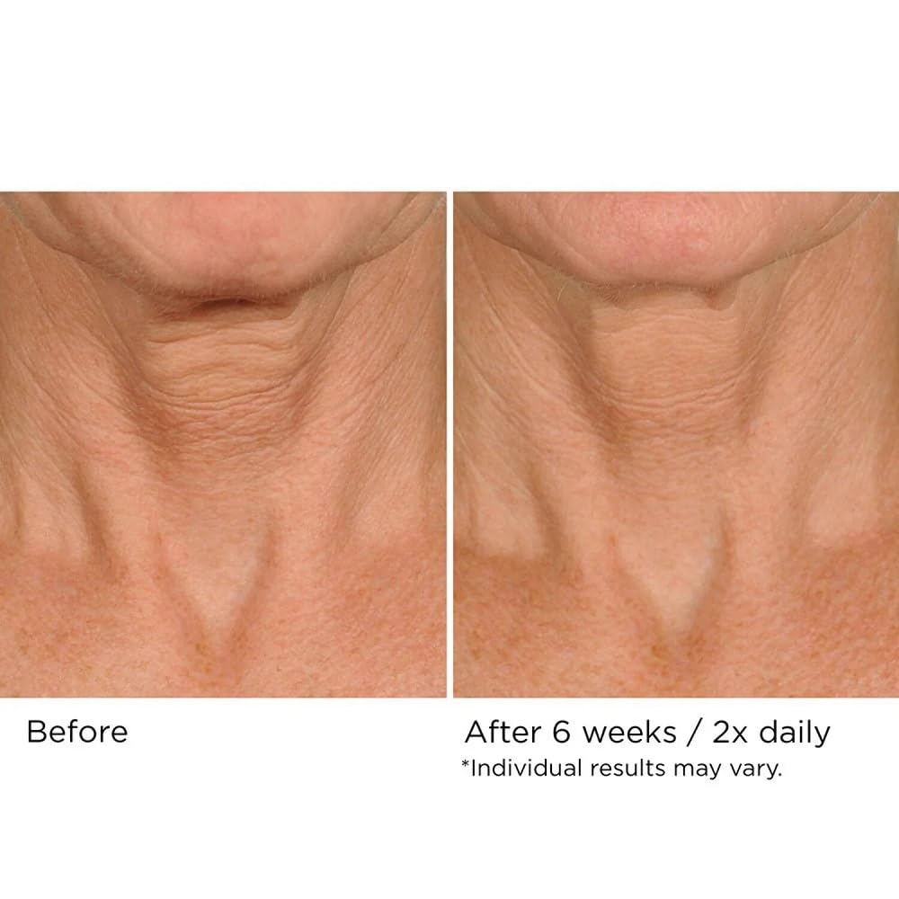 NassifMD Deco-Lift Neck Firming Complex Serum | Lightweight Gel for Neck & Décolletage