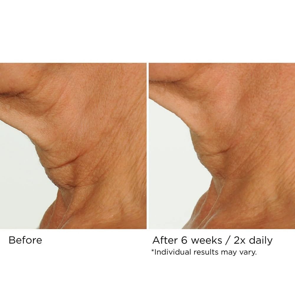 NassifMD Deco-Lift Neck Firming Complex Serum | Lightweight Gel for Neck & Décolletage