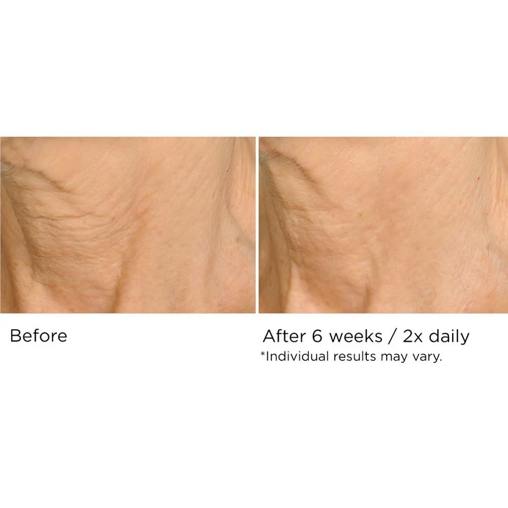 NassifMD Deco-Lift Neck Firming Complex Serum | Lightweight Gel for Neck & Décolletage