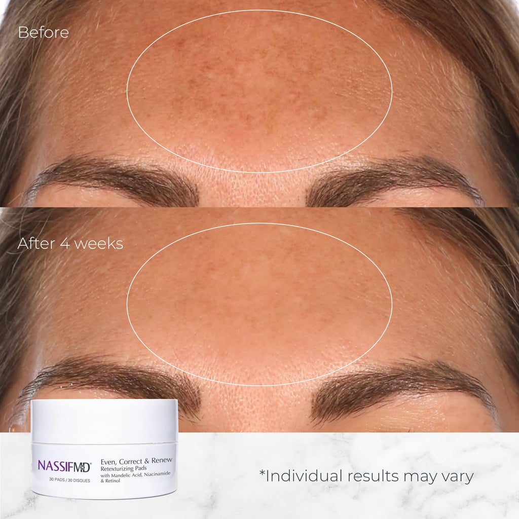 NassifMD Even, Correct & Renew Retexturizing Pads | Facial Peel for Texture & Tone