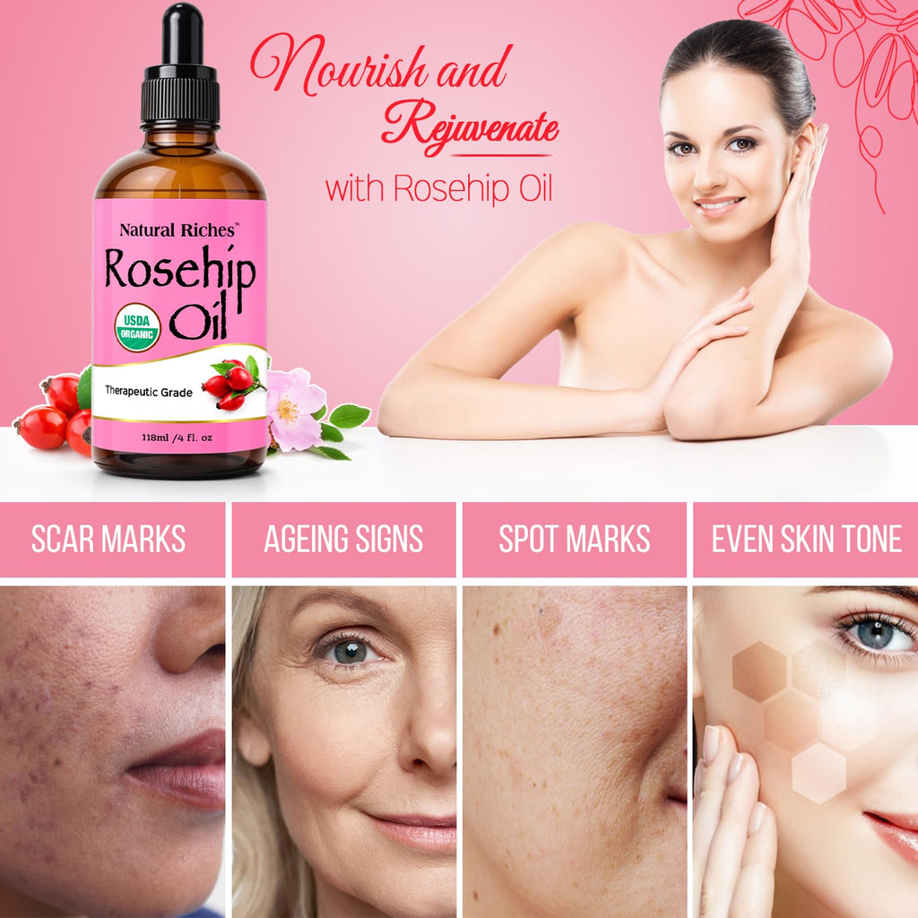Natural Riches Organic Rosehip Seed Oil – 100% Pure, Cold-Pressed, 4 oz