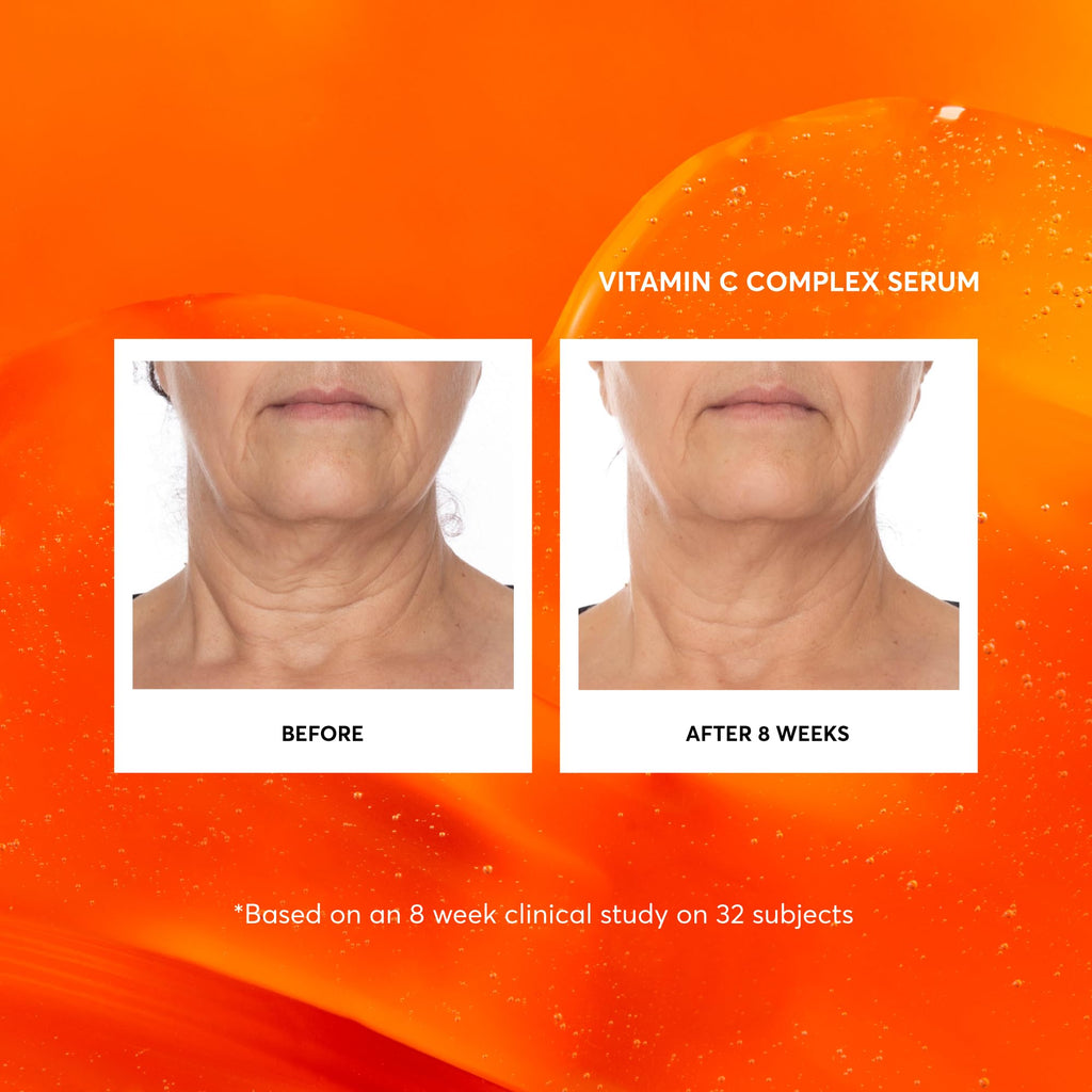 Naturium Vitamin C Complex Serum Jumbo – Hydration & Anti-Aging with Hyaluronic Acid