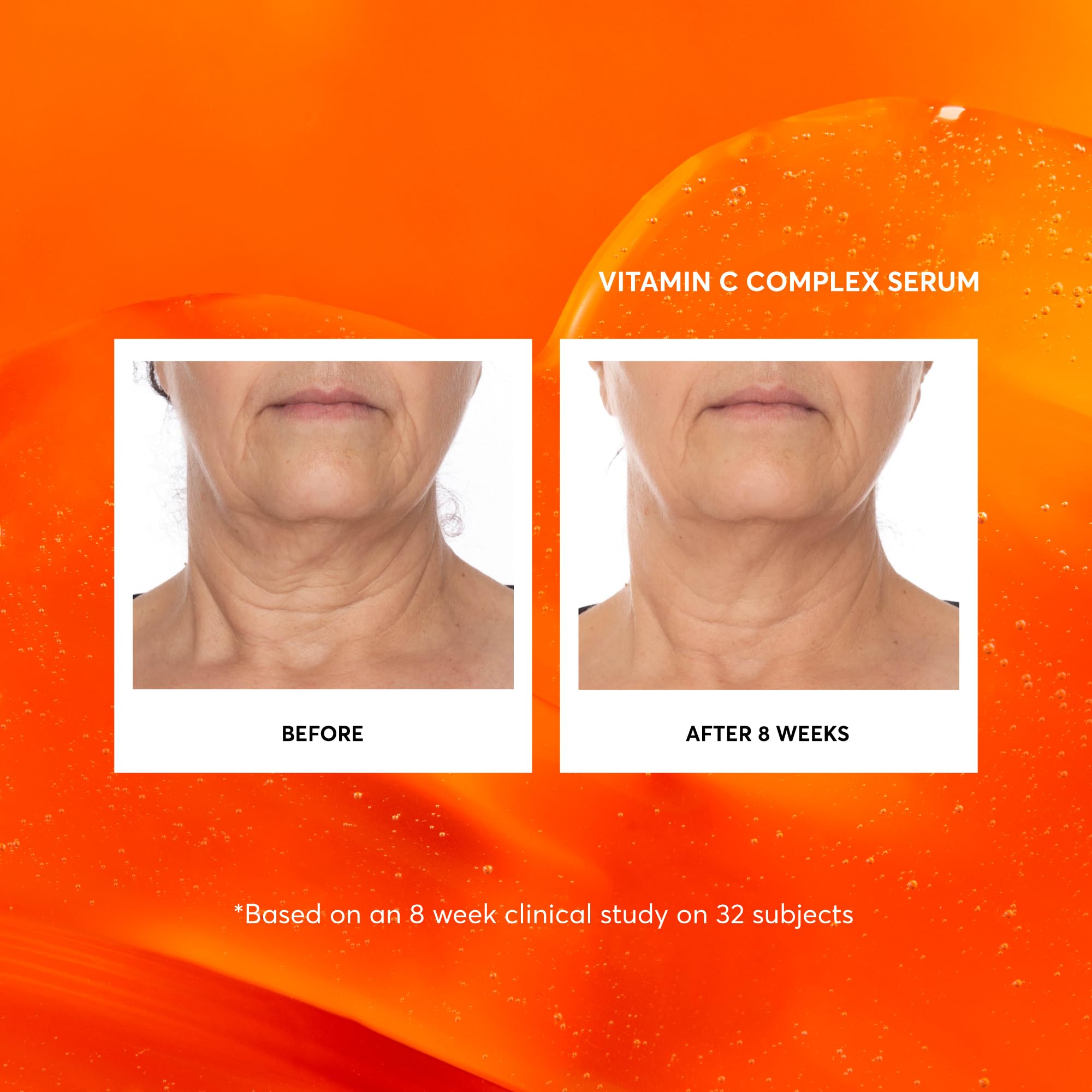 Naturium Vitamin C Complex Serum Jumbo – Hydration & Anti-Aging with Hyaluronic Acid