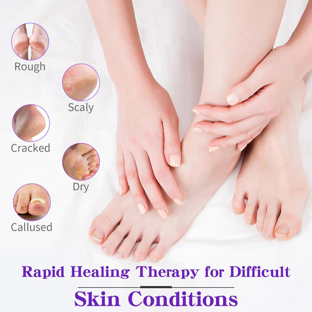 NBC BeautiLab Foot Callus Remover & Hand & Foot Cream – 80ml Lavender, Deep Hydration for Dry Skin