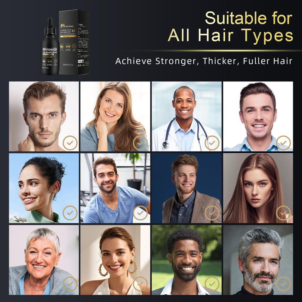 NETYIYUN 5% Minoxidil for Women and Men – Fuller, Thicker Hair (2 oz)