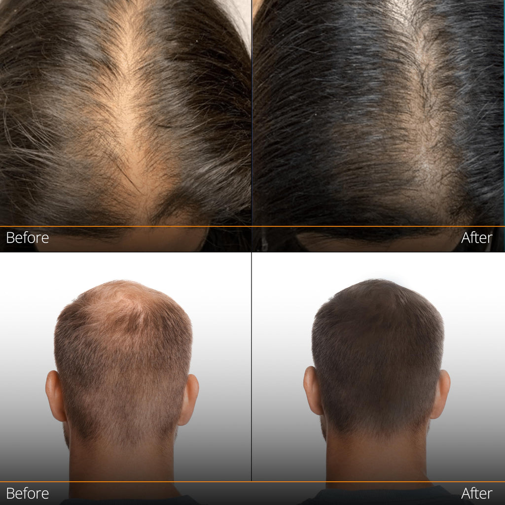NHTLab Hair Growth Serum for Men & Women - Caffeine & Biotin for Strong Roots (60ml)