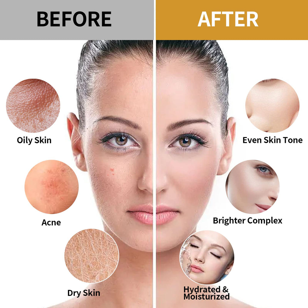Nielies Jelly Mask for Facial – Hydrating Vegan Peel-Off Mask with Vitamin C