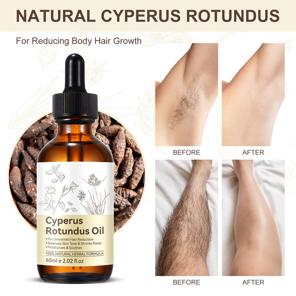 NIFEISHI Cyperus Rotundus Oil for Hair Removal – Gentle, Moisturizing Formula (60ml)