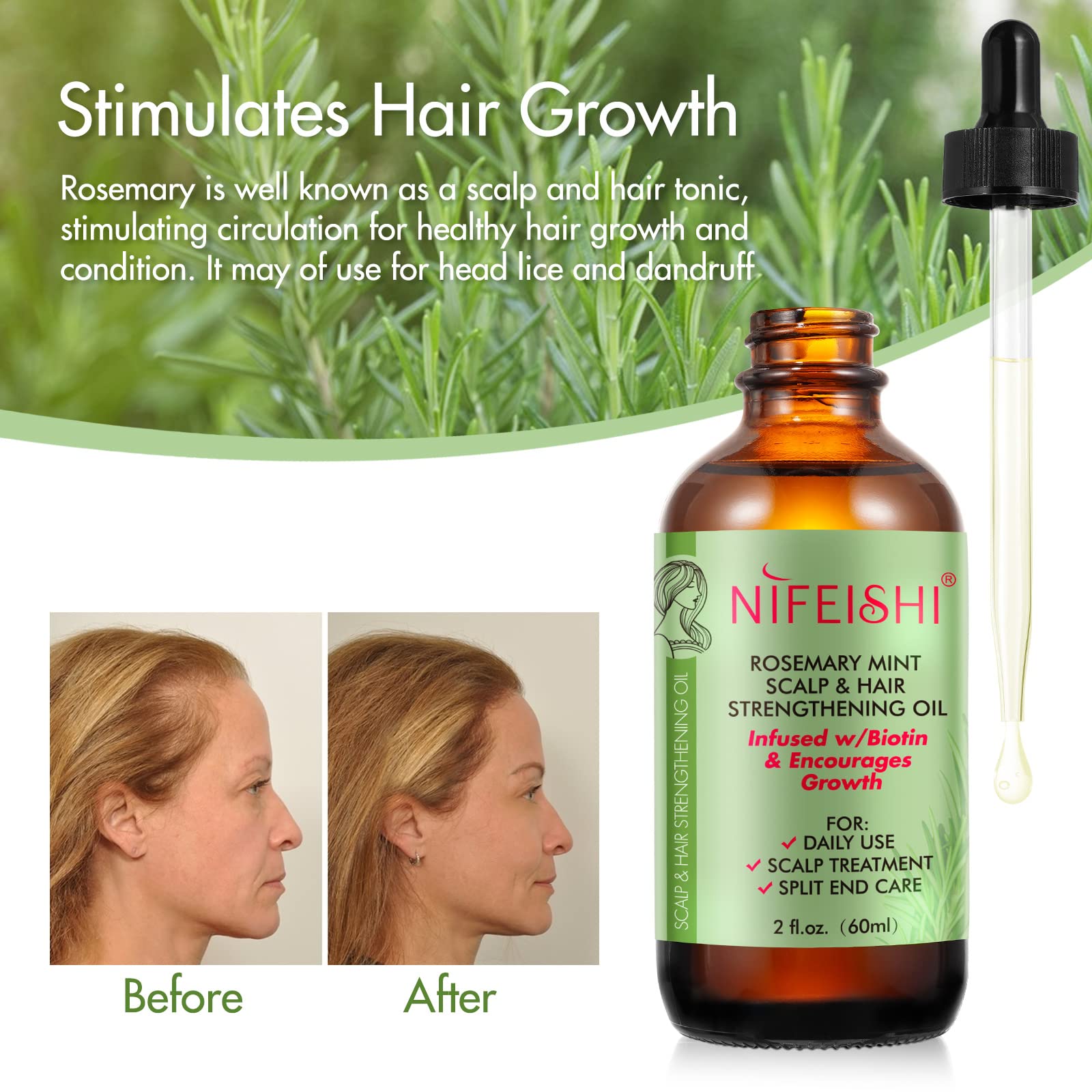NIFEISHI Organic Rosemary Oil for Hair Growth & Strengthening - 60ml