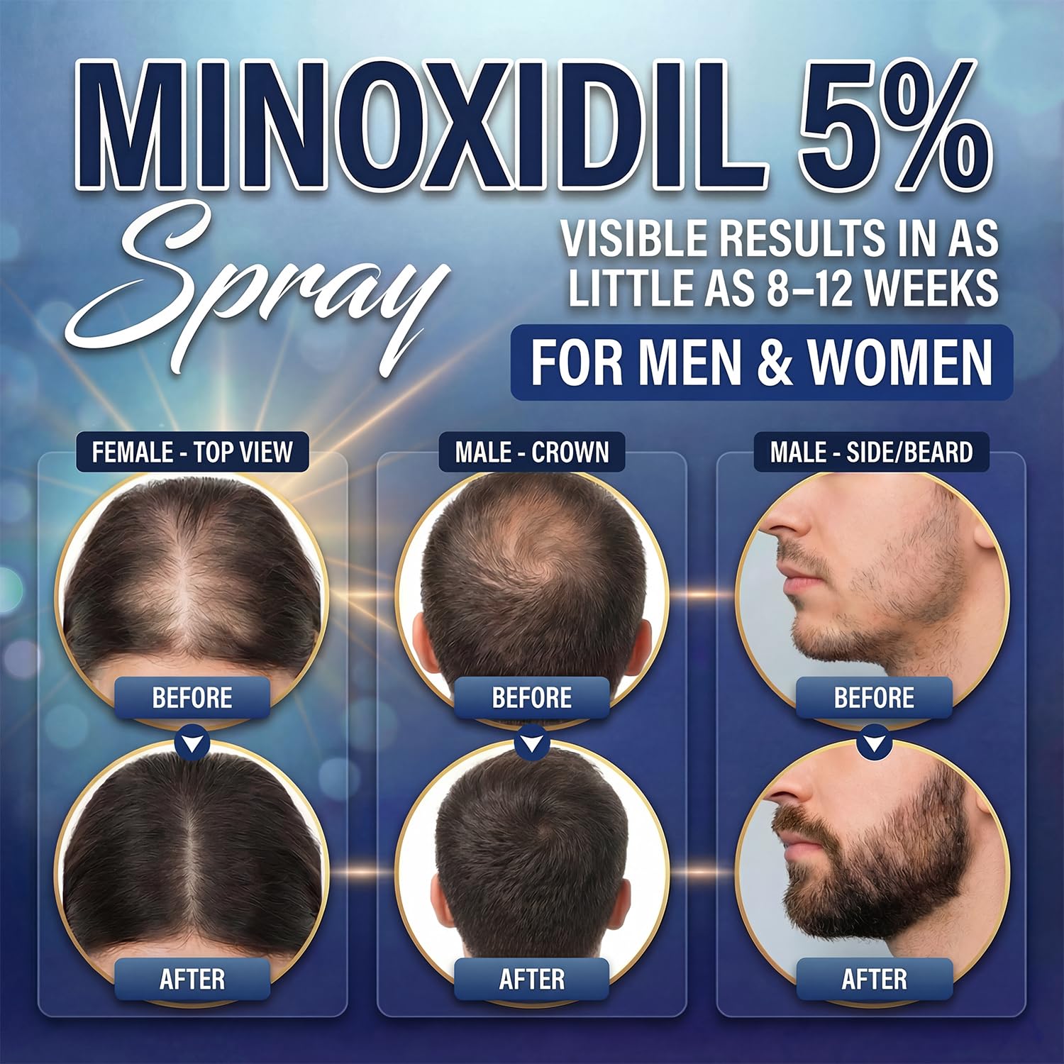 Nigwedete Minoxidil 5% for Men (120 ML) – Hair & Beard Growth Serum with Provitamin B5 & Castor Seed Extract