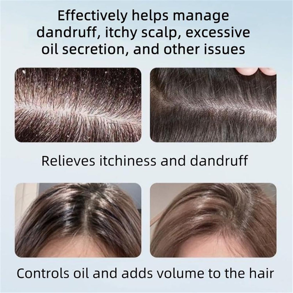 Nipori Anti-Dandruff Shampoo – Oil Control & Color-Protecting Hair Care (2 x 8 fl oz)
