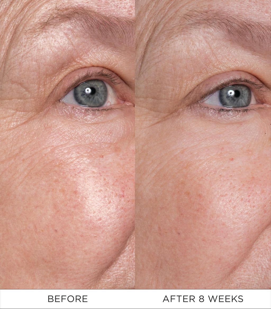 Noble Panacea Eye Lift Concentrate 12 Doses Refill | Luxury Eye Cream for Lifting & Firming