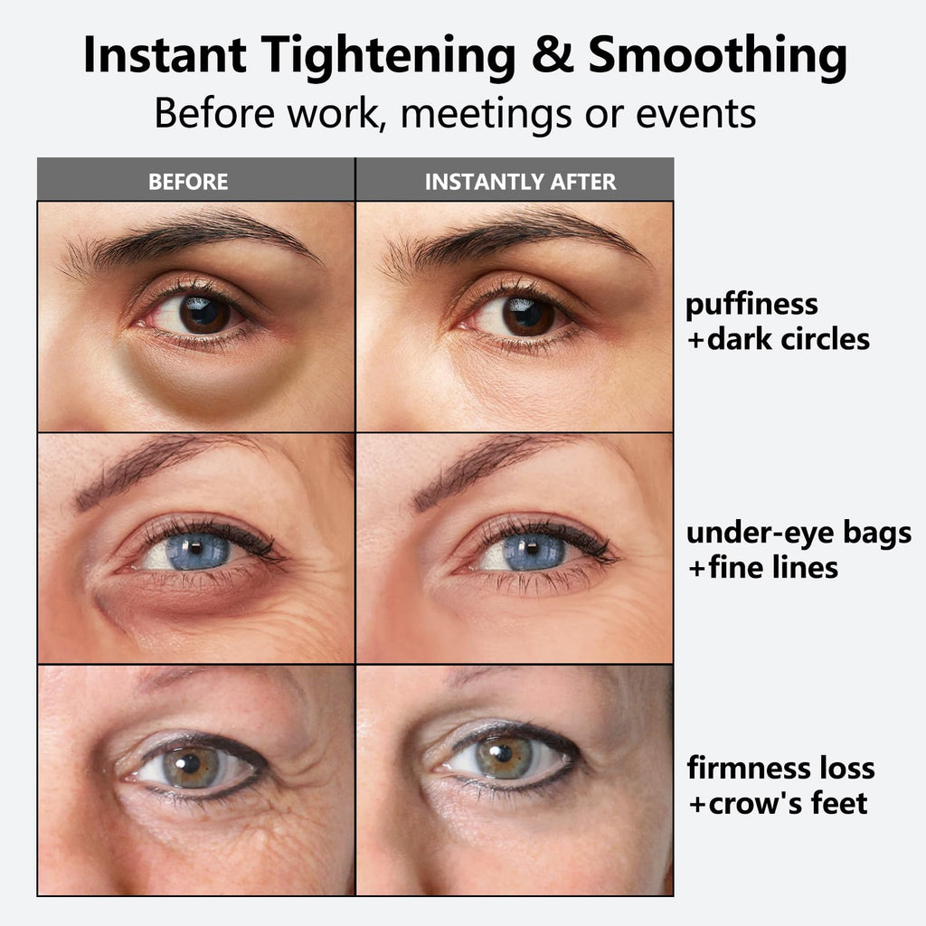 Nofitp Instant Eye Tightener – 3-Minute Firming Serum for Eye Bags, Dark Circles & Fine Lines | 1 oz