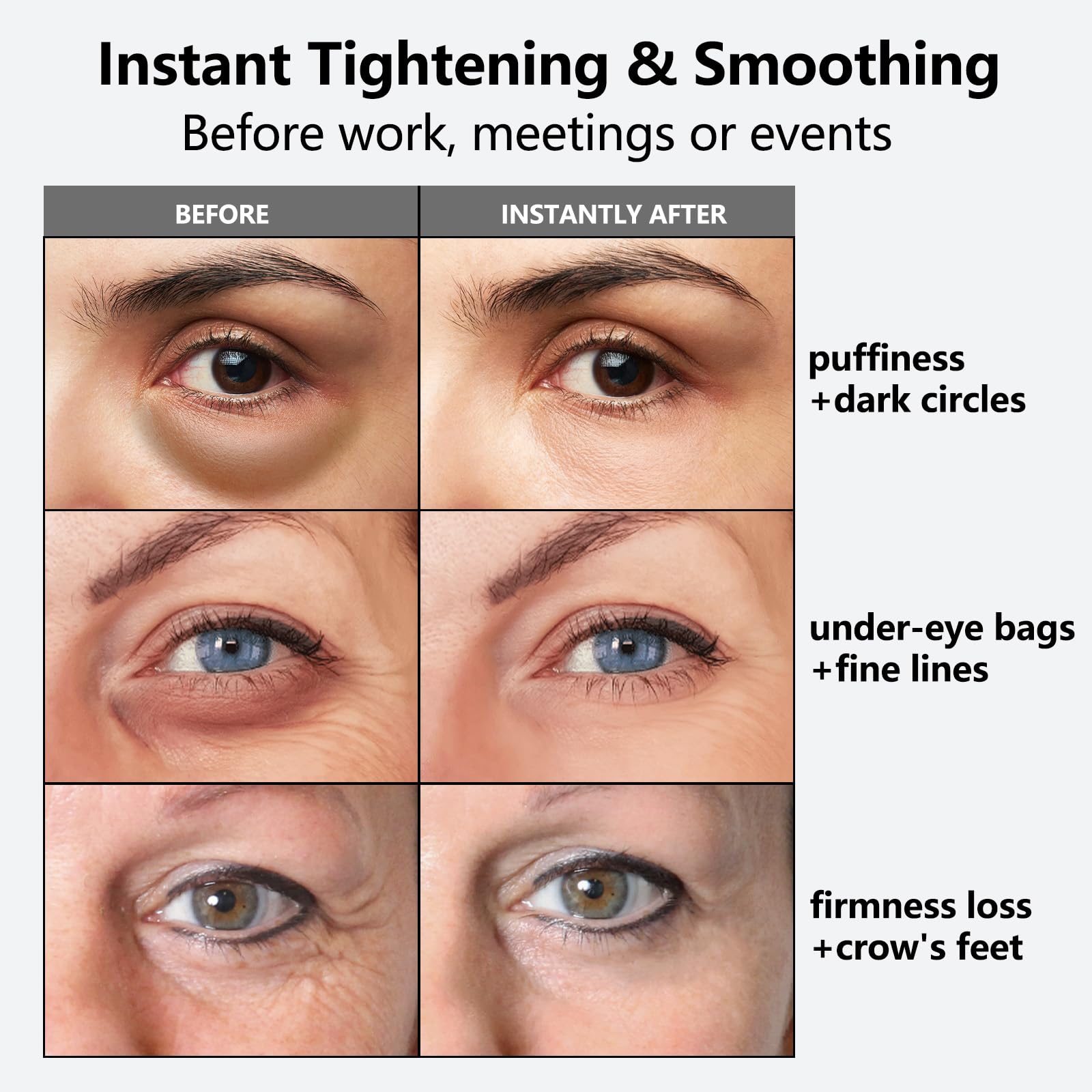 Nofitp Instant Eye Tightener – 3-Minute Firming Serum for Eye Bags, Dark Circles & Fine Lines | 1 oz