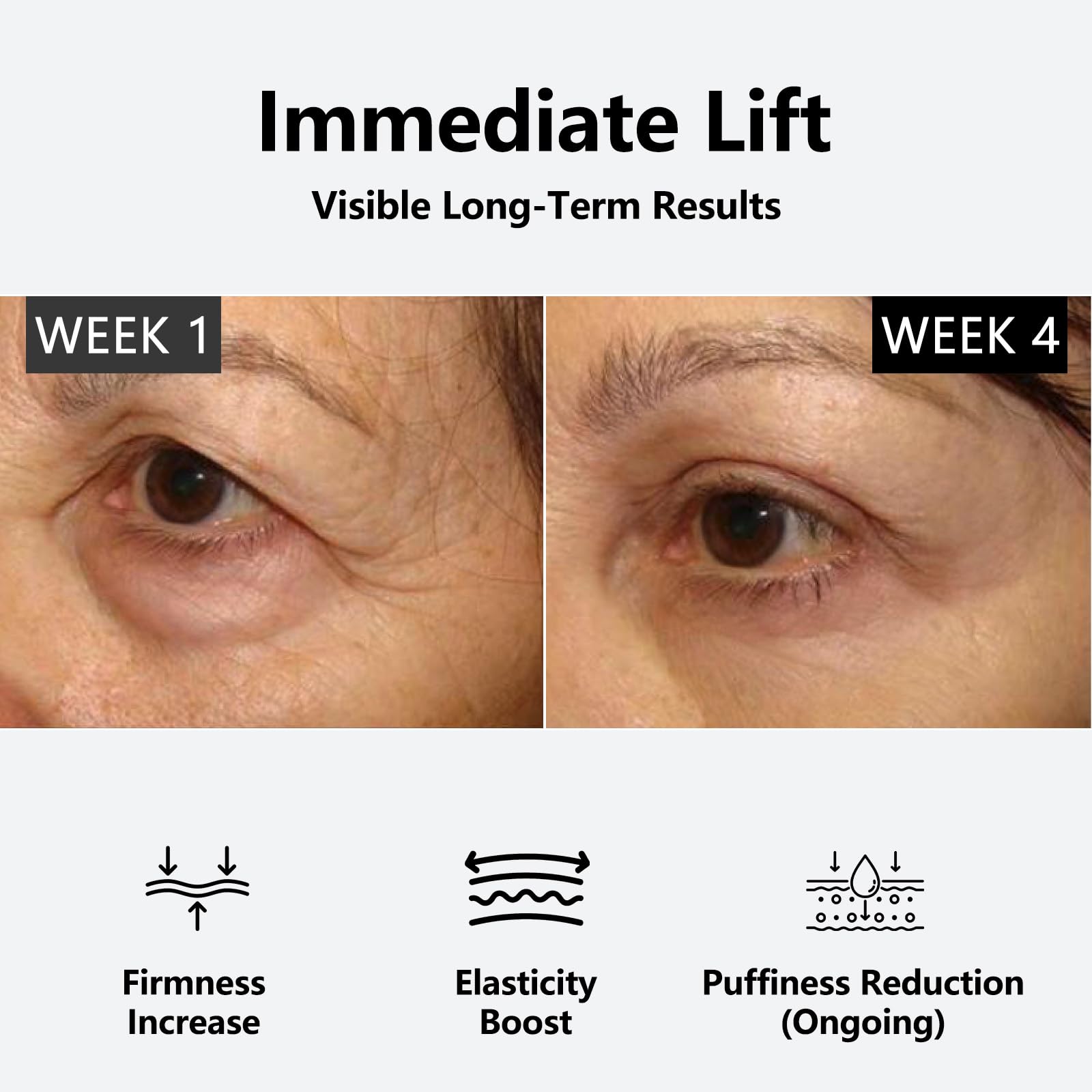 Nofitp Instant Eye Tightener – 3-Minute Firming Serum for Eye Bags, Dark Circles & Fine Lines | 1 oz