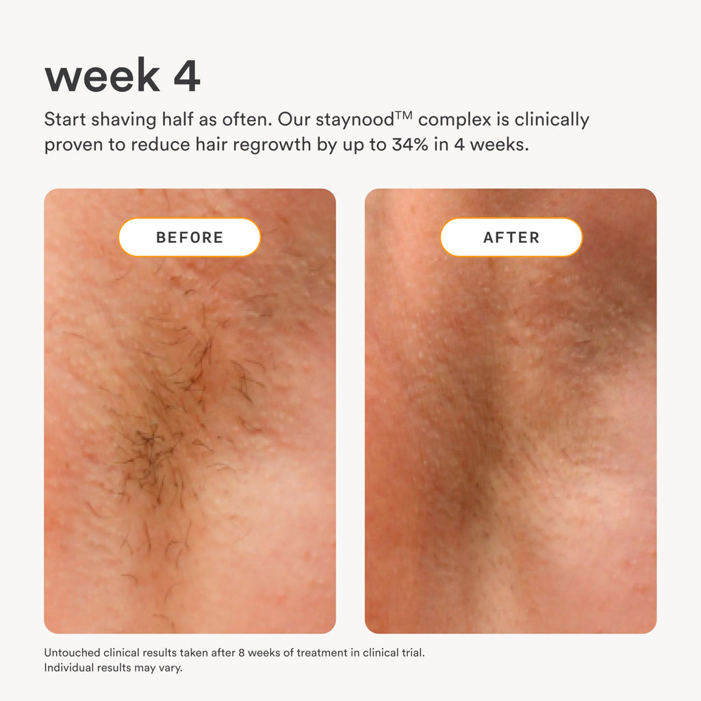 Nood NEW Serum — Slow Hair Regrowth, Shave Less, Ingrown Hair Care