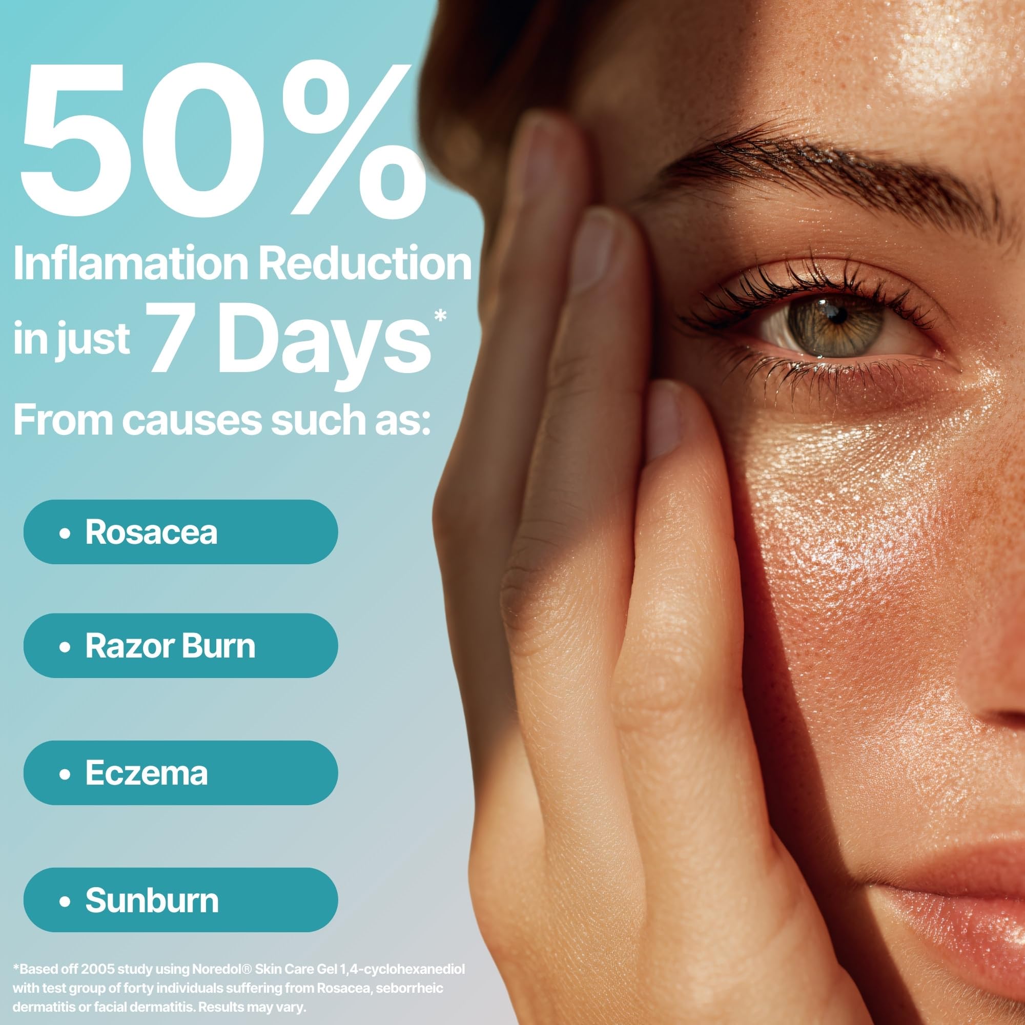 Noredol Redness Relief Gel | Patented 1,4-Cyclohexanediol Barrier Repair | Fragrance-Free 0.5 oz