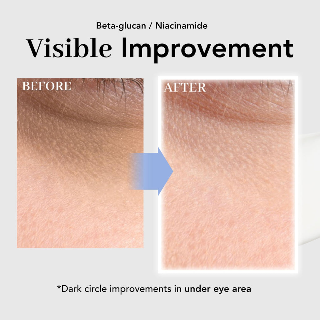 NOWATER Collagen Eye Cream for Wrinkles, Puffiness & Dark Circles | Hydrolyzed Collagen + Beta-Glucan