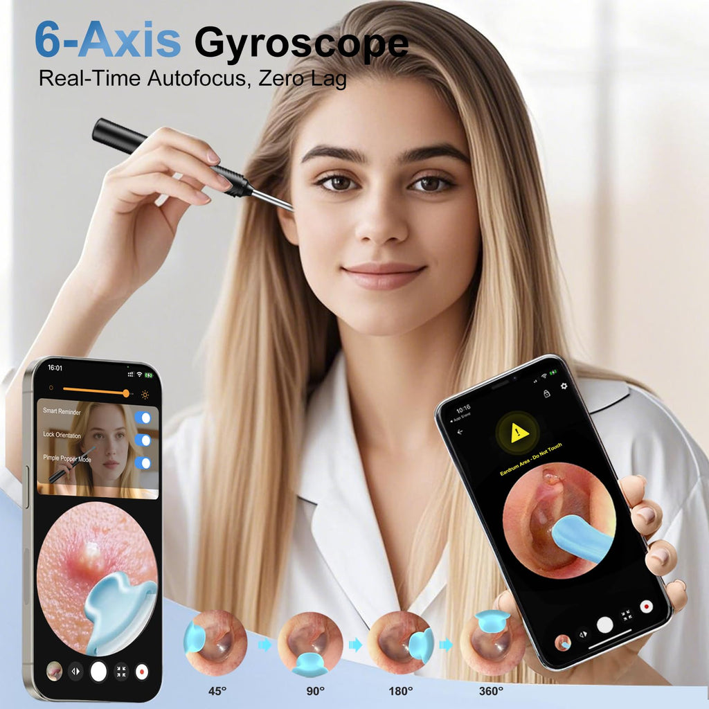Ntgiso AI Eardrum Alert & Ear Wax Removal Kit — 1080P HD Otoscope Camera, 6-Axis Gyro, Waterproof Lens
