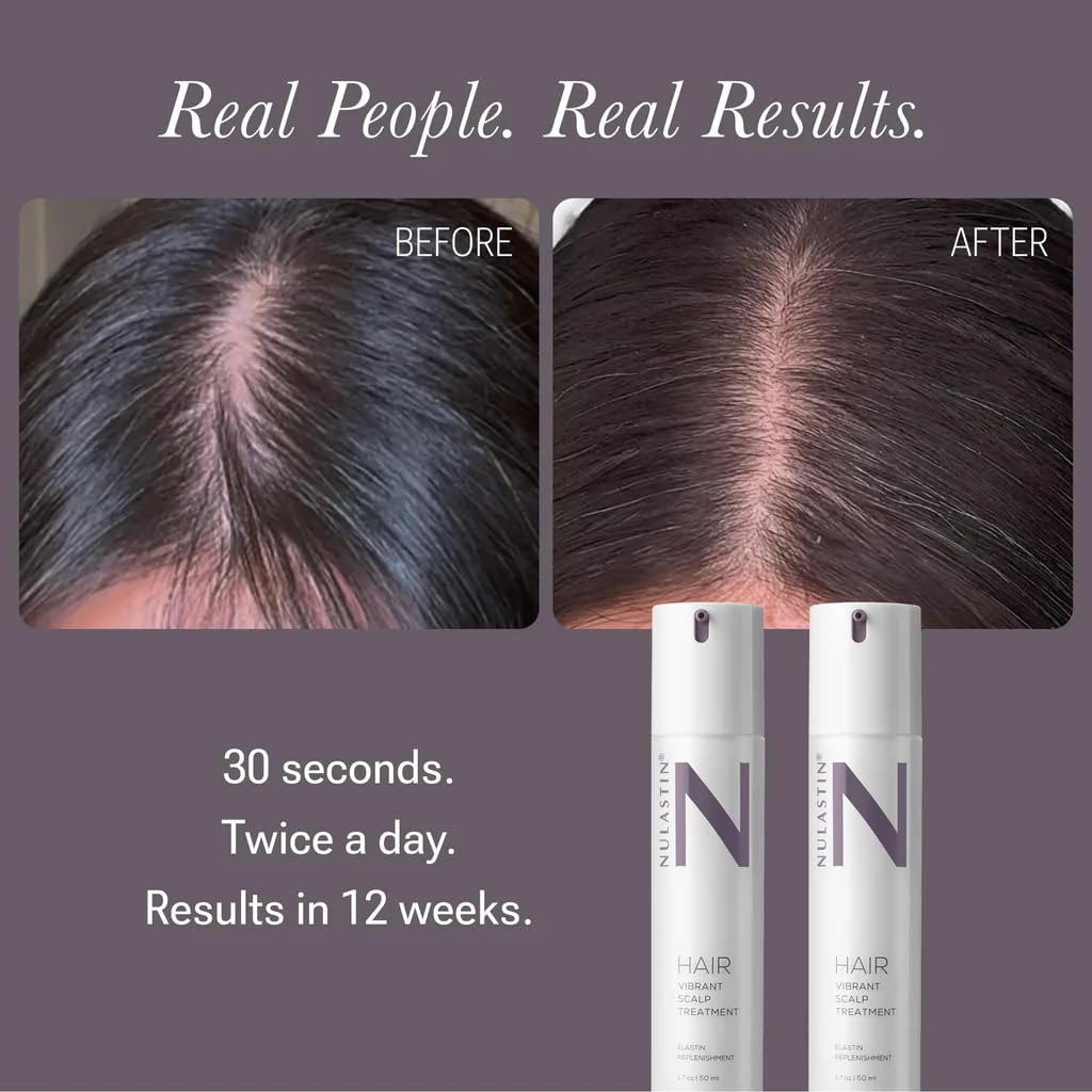 NULASTIN Scalp Serum — Lightweight, Fast-Absorbing Treatment for Hair Density (1.7 oz)