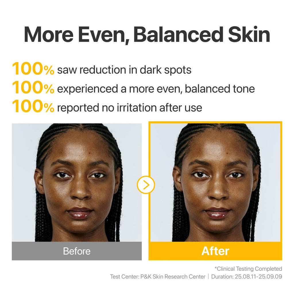 numbuzin No.5 Glutathione TXA Dark Spot Ampoule – Targeted Tone Care for Uneven Skin