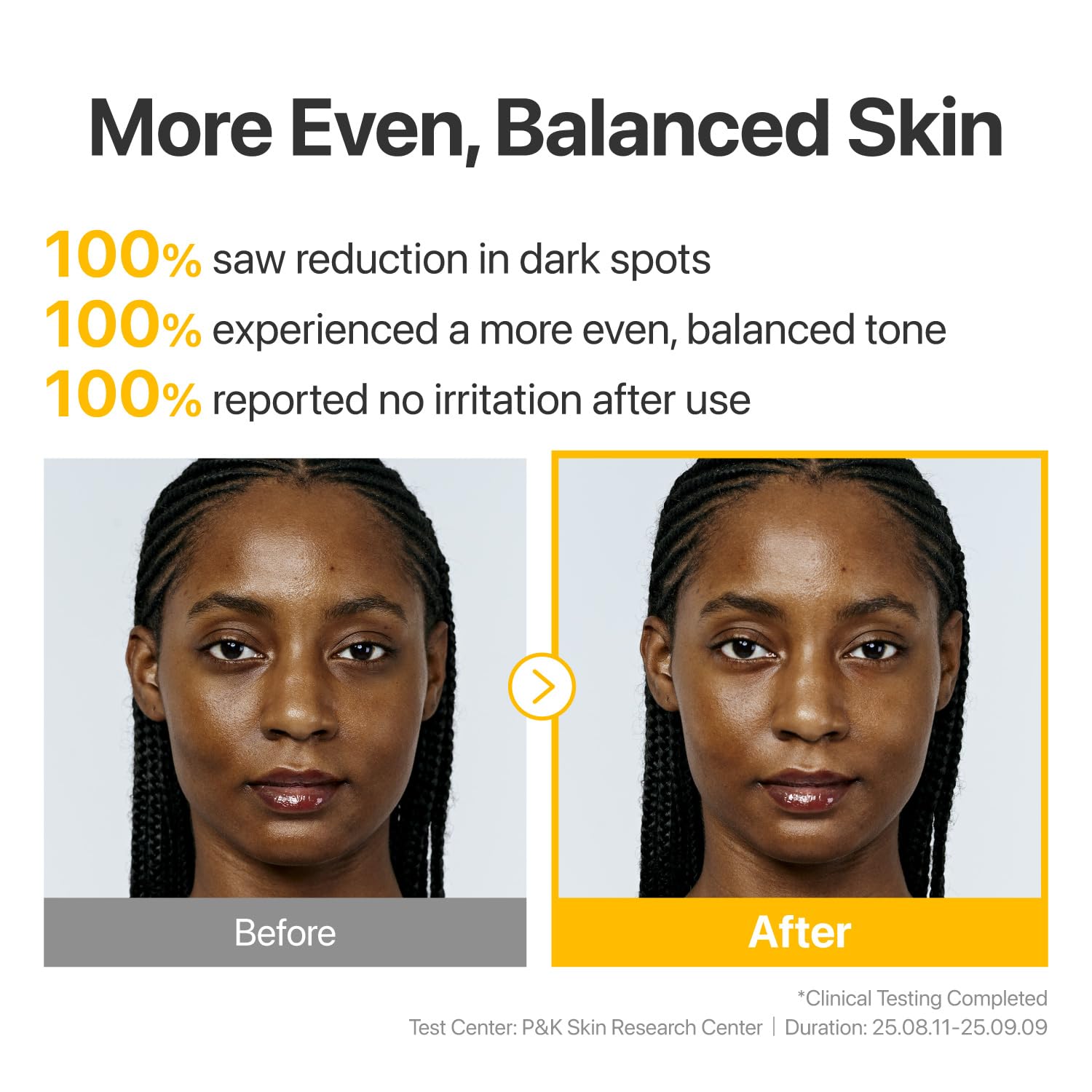 numbuzin No.5 Glutathione TXA Dark Spot Ampoule – Targeted Tone Care for Uneven Skin