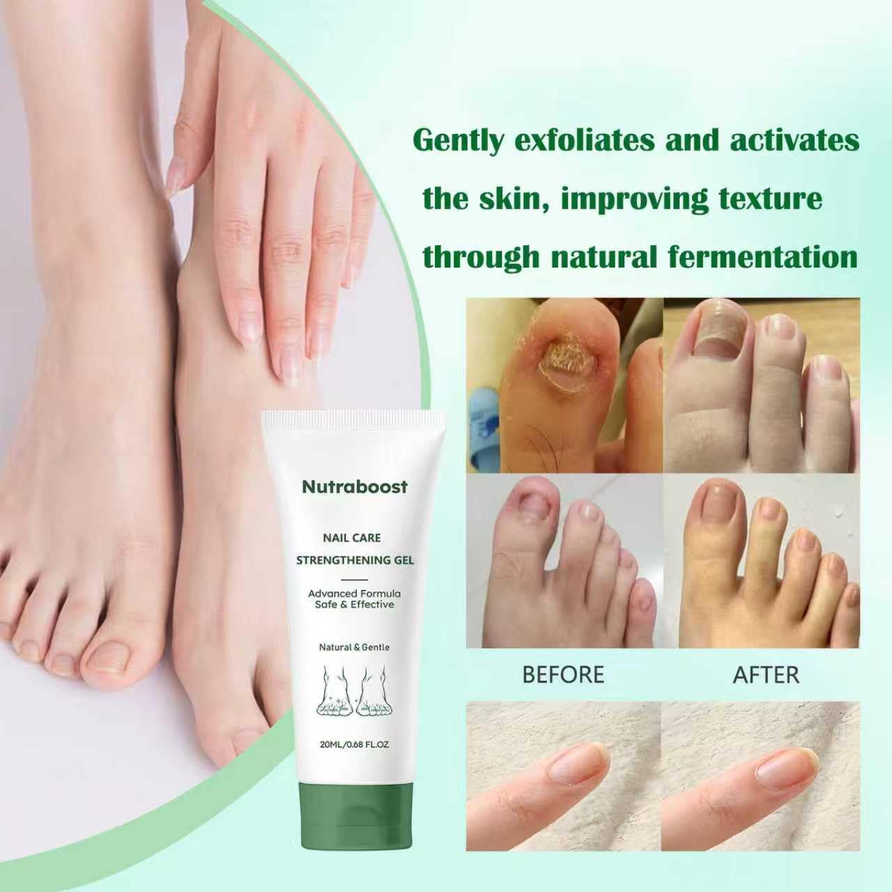 Nutraboost Natural Nail Care Gel – Strengthening Cuticle Serum for Damaged Nails, 20 ml (Pack of 3)