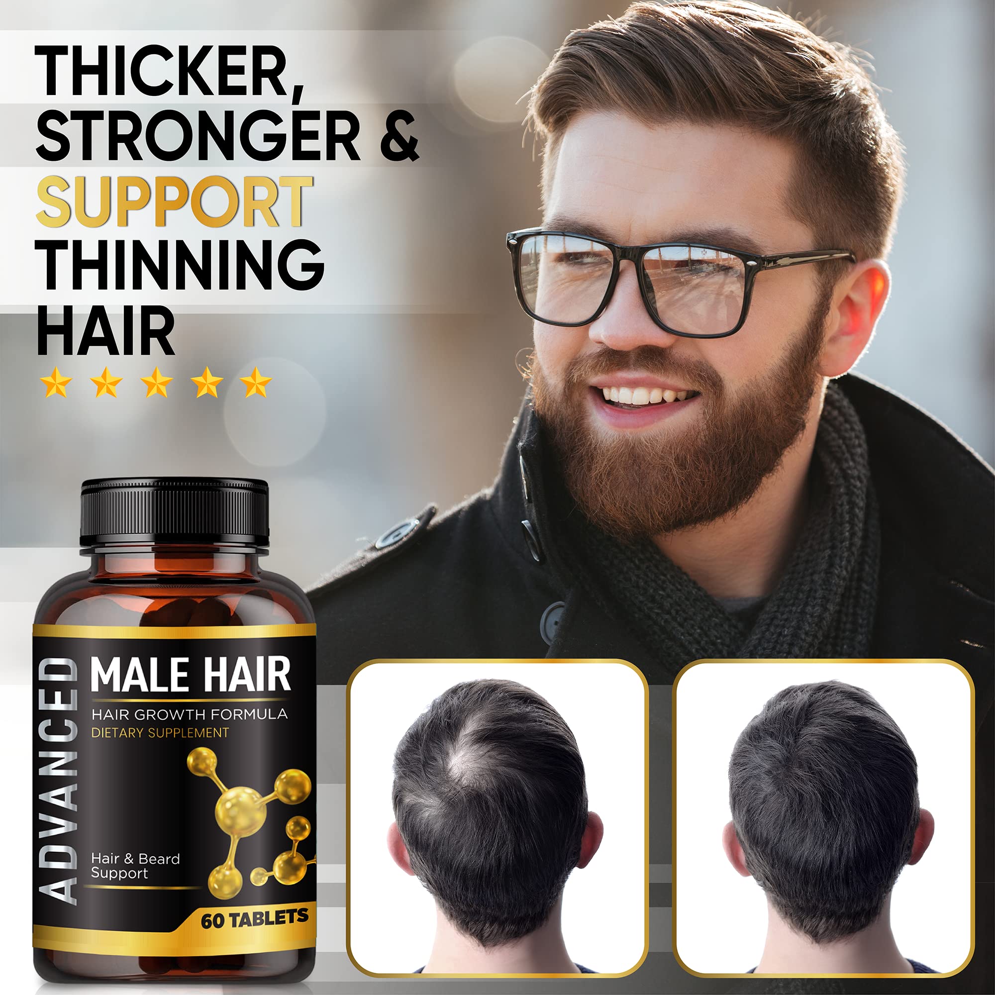 NutraPro Hair Growth Vitamins for Men – Thicker, Fuller Hair & Beard Support