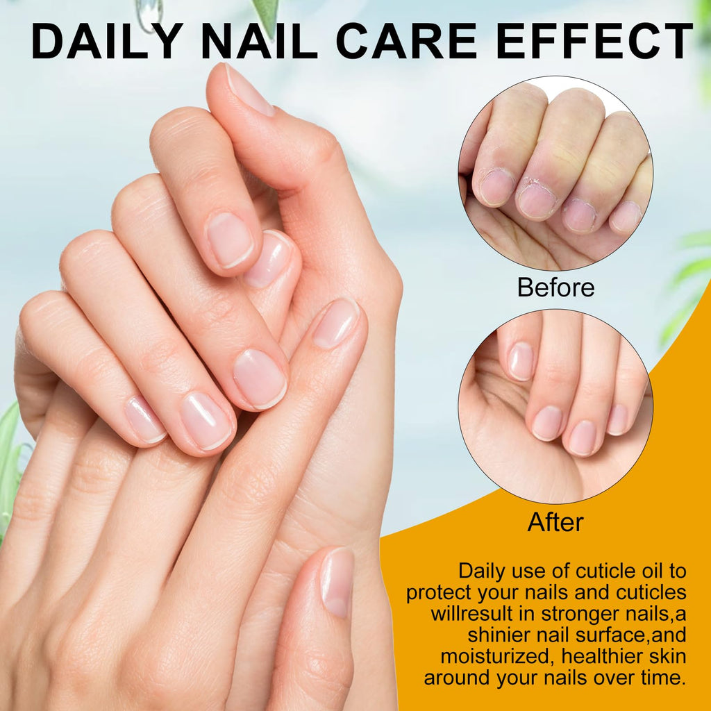 NXJ INFILILA Natural Cuticle Oil for Nails – Deep Hydration with Milk & Honey