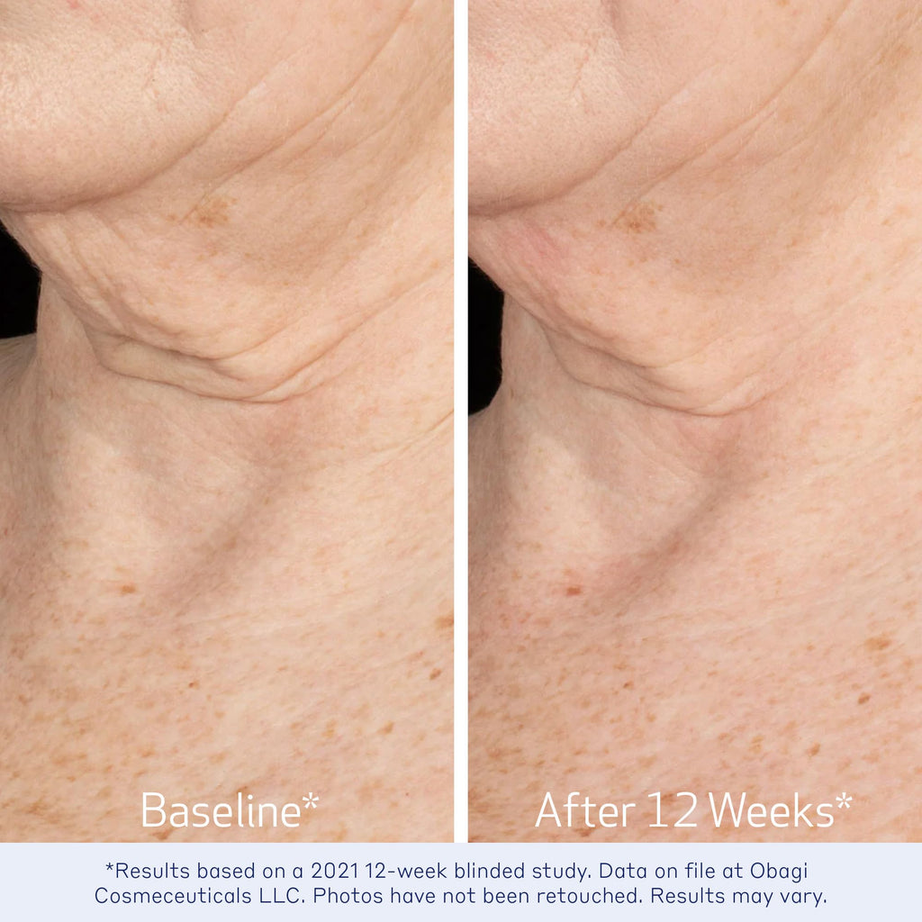Obagi ELASTIderm Neck & Décolleté Lifting Concentrate – Bi-Mineral Contour Complex, Retinoid & Alpha-Arbutin, 2 oz