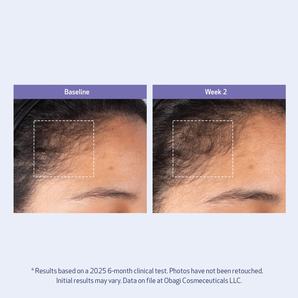 Obagi Nu-Cil BioStim Hair Serum with Biotin – Fuller, Denser Hair & Healthy Scalp (2 oz)