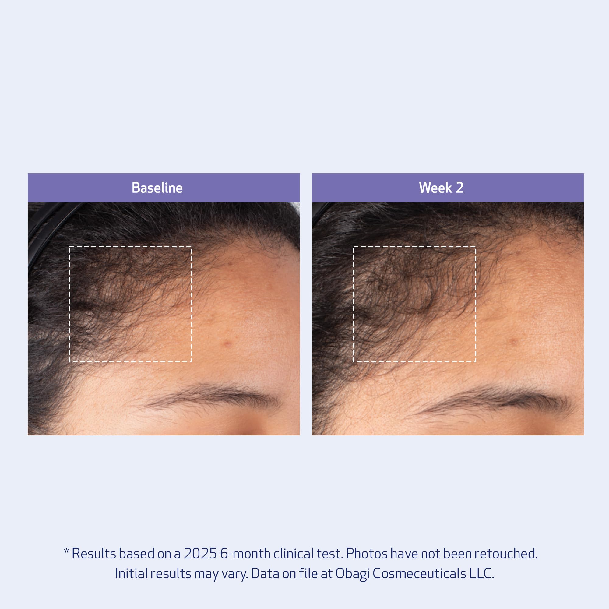 Obagi Nu-Cil BioStim Hair Serum with Biotin – Fuller, Denser Hair & Healthy Scalp (2 oz)