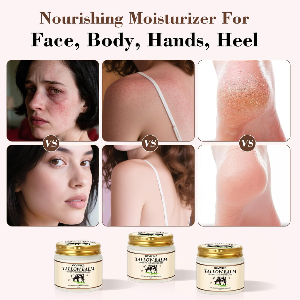 OCVWJKD Beef Tallow & Honey Balm – 3-Pack All-Natural Skin Moisturizer for Face & Body | Grass-Fed Tallow & Raw Honey Blend | 6 Oz