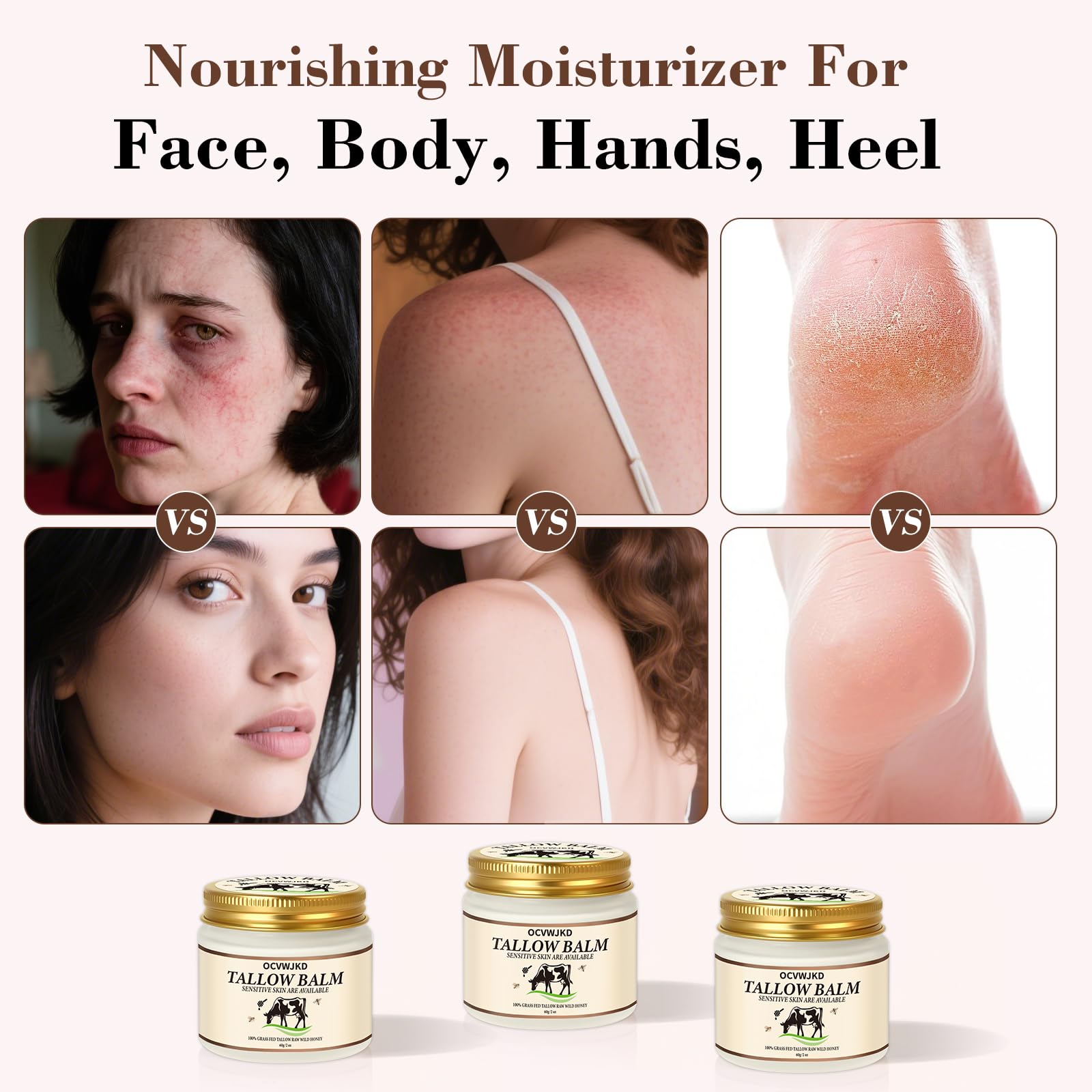 OCVWJKD Beef Tallow & Honey Balm – 3-Pack All-Natural Skin Moisturizer for Face & Body | Grass-Fed Tallow & Raw Honey Blend | 6 Oz