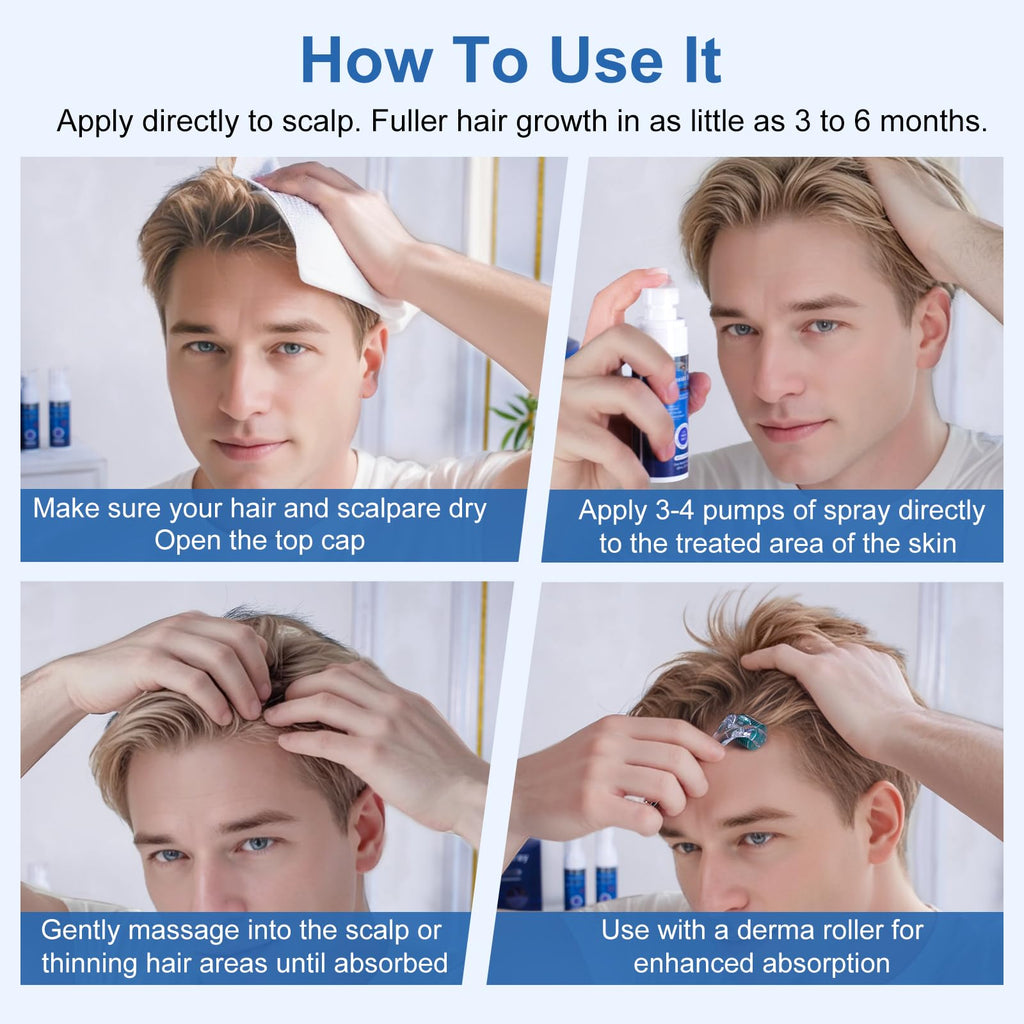 OCVWJKD 5% Minoxidil Spray for Hair Regrowth — Extra Strength 60ml x 7 Bottles