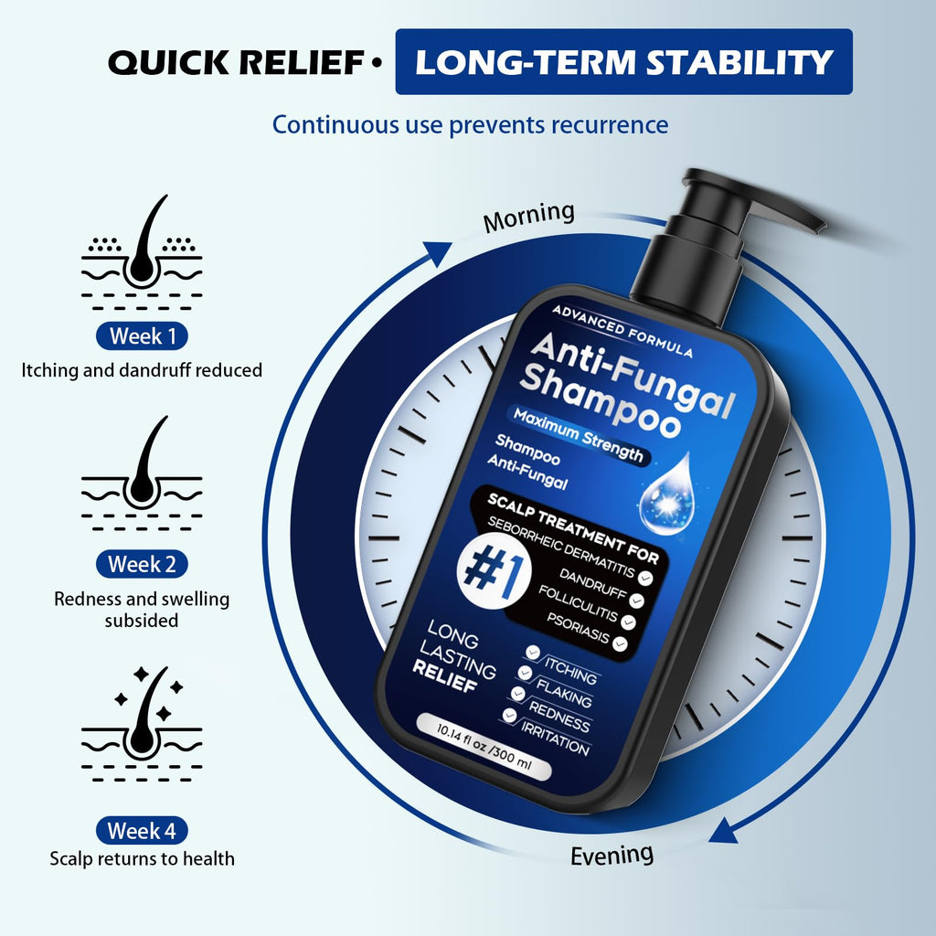 Oely Anti-Dandruff Shampoo for Folliculitis & Scalp Psoriasis | 10.1 fl oz