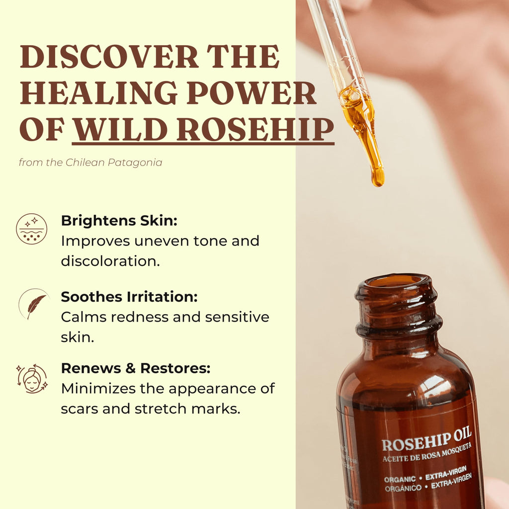 Offernova Organic Rosehip Oil – Cold-Pressed Rosa Mosqueta, USDA Organic, 1 oz