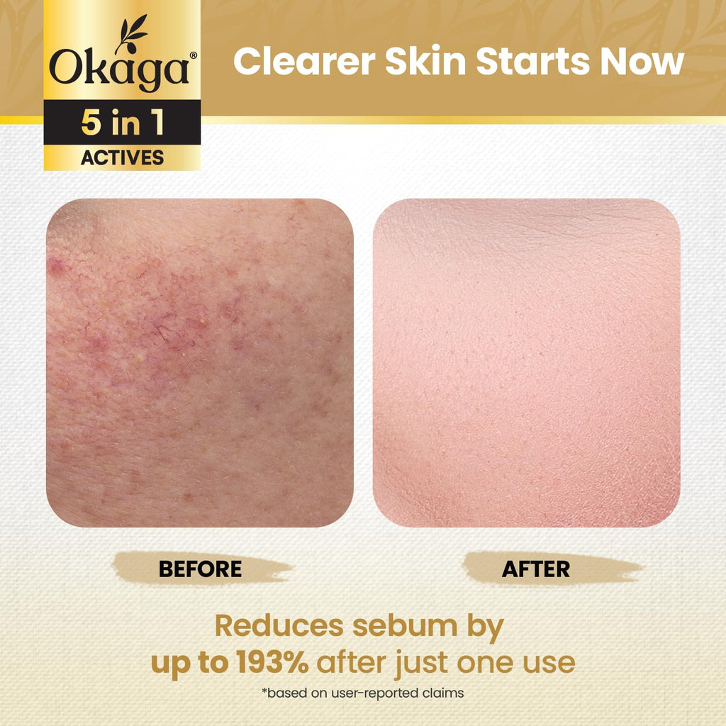 Okaga Rice Peel Shot Ampoule – Gentle Rice Exfoliant for Bright, Hydrated Skin (90 mL)