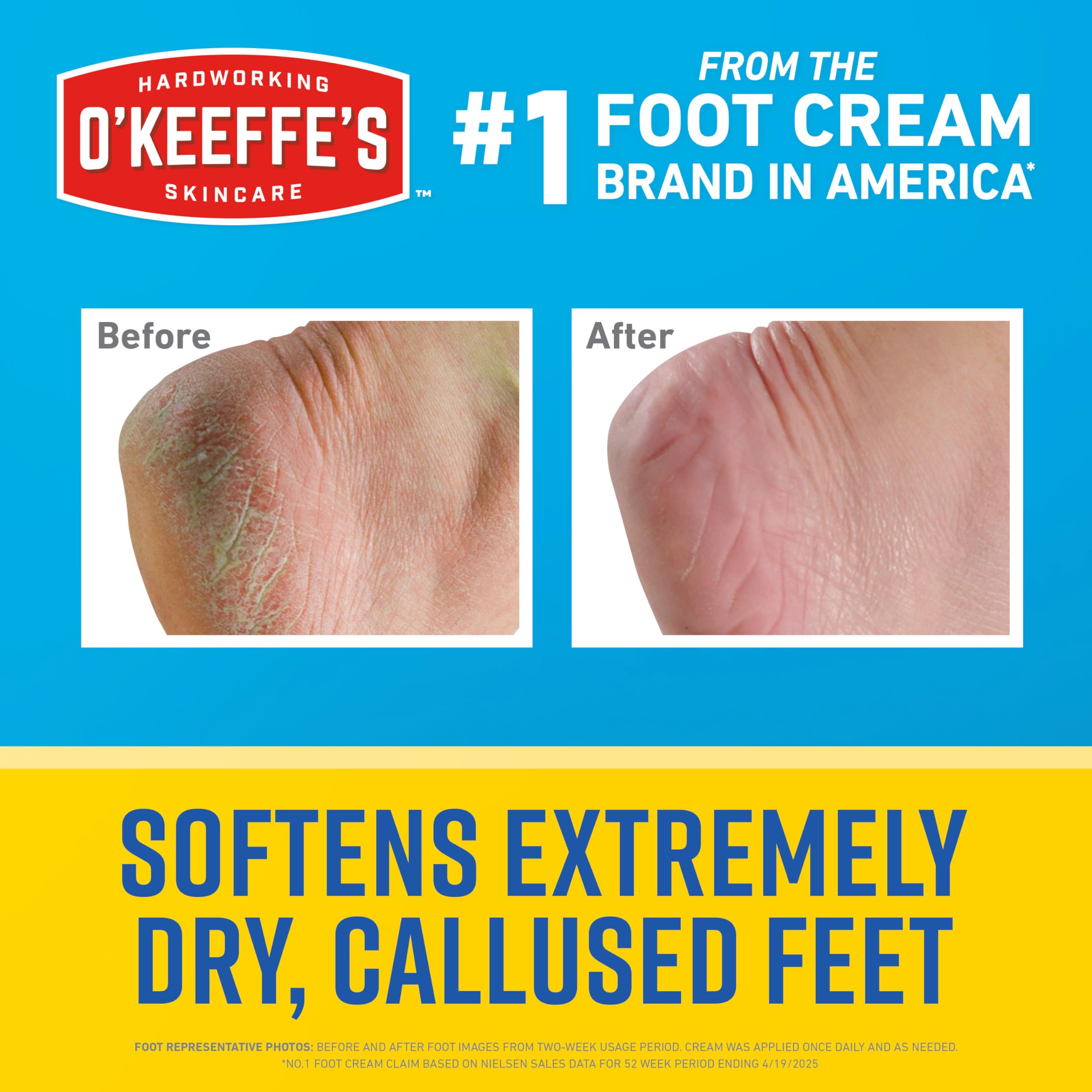 O'Keeffe's for Healthy Feet Intense Renewal Cream with Urea & Alpha Hydroxy Acid, 3 oz Tube