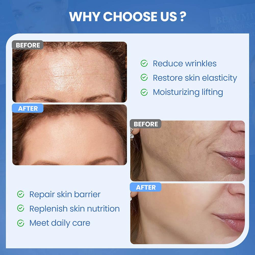 Okela Forehead & Smile Line Patches Overnight — Hydrogel Smoothing Patches