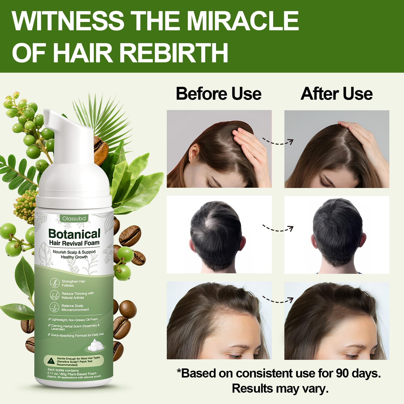 Olassubd Hair Growth Oil Foam – Rosemary & Castor Oil (Vegan, Non-Greasy) Scalp Treatment – Pack of 3 Bottles