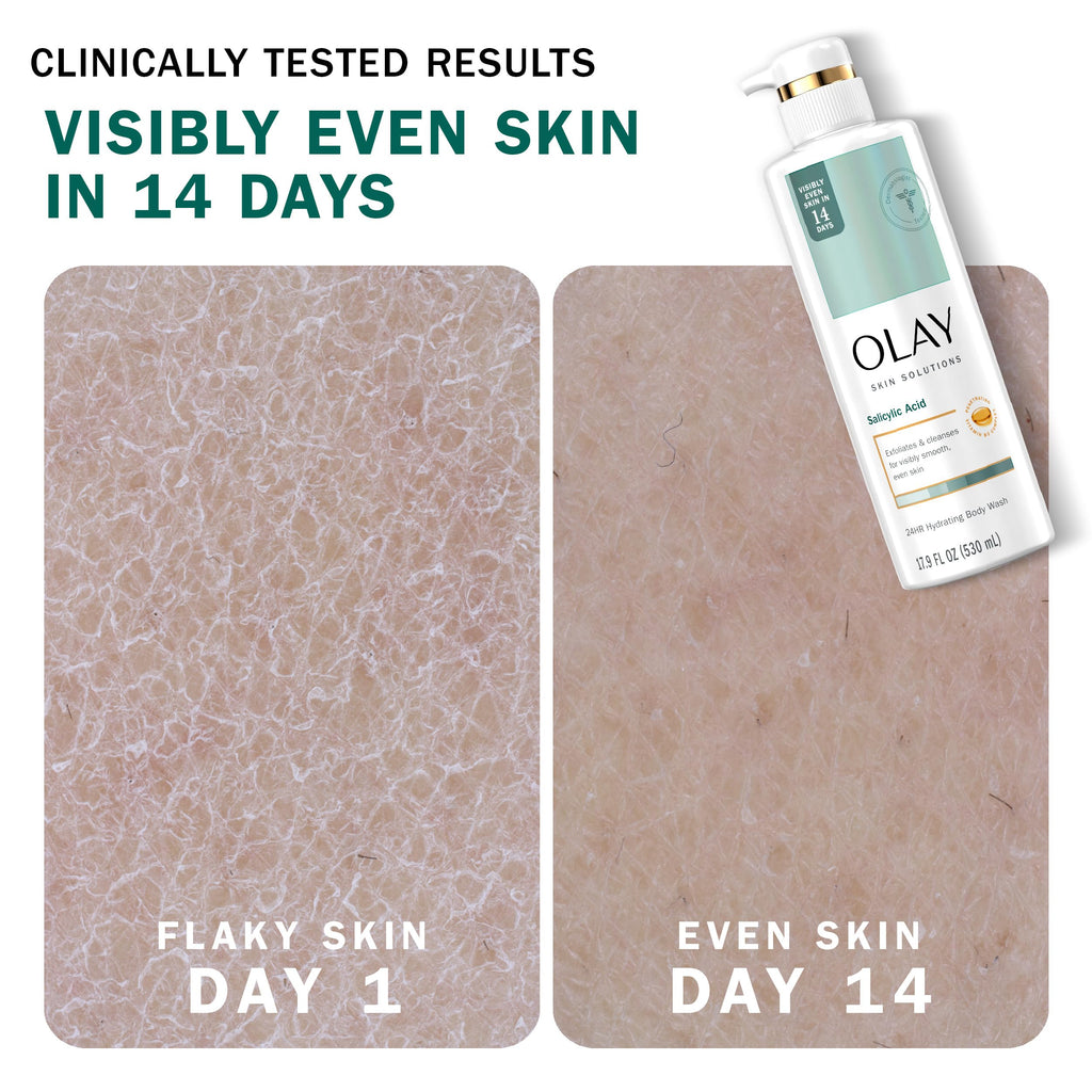 Olay Skin Solutions Hydrating Body Wash with Salicylic Acid – 4 x 17.9 fl oz