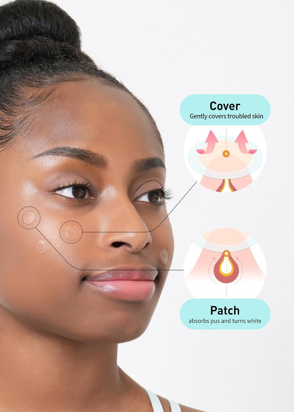 OLIVE YOUNG Care Plus Spot Patch | Hydrocolloid Acne Patches (Pack of 2, 60 Patches Total)