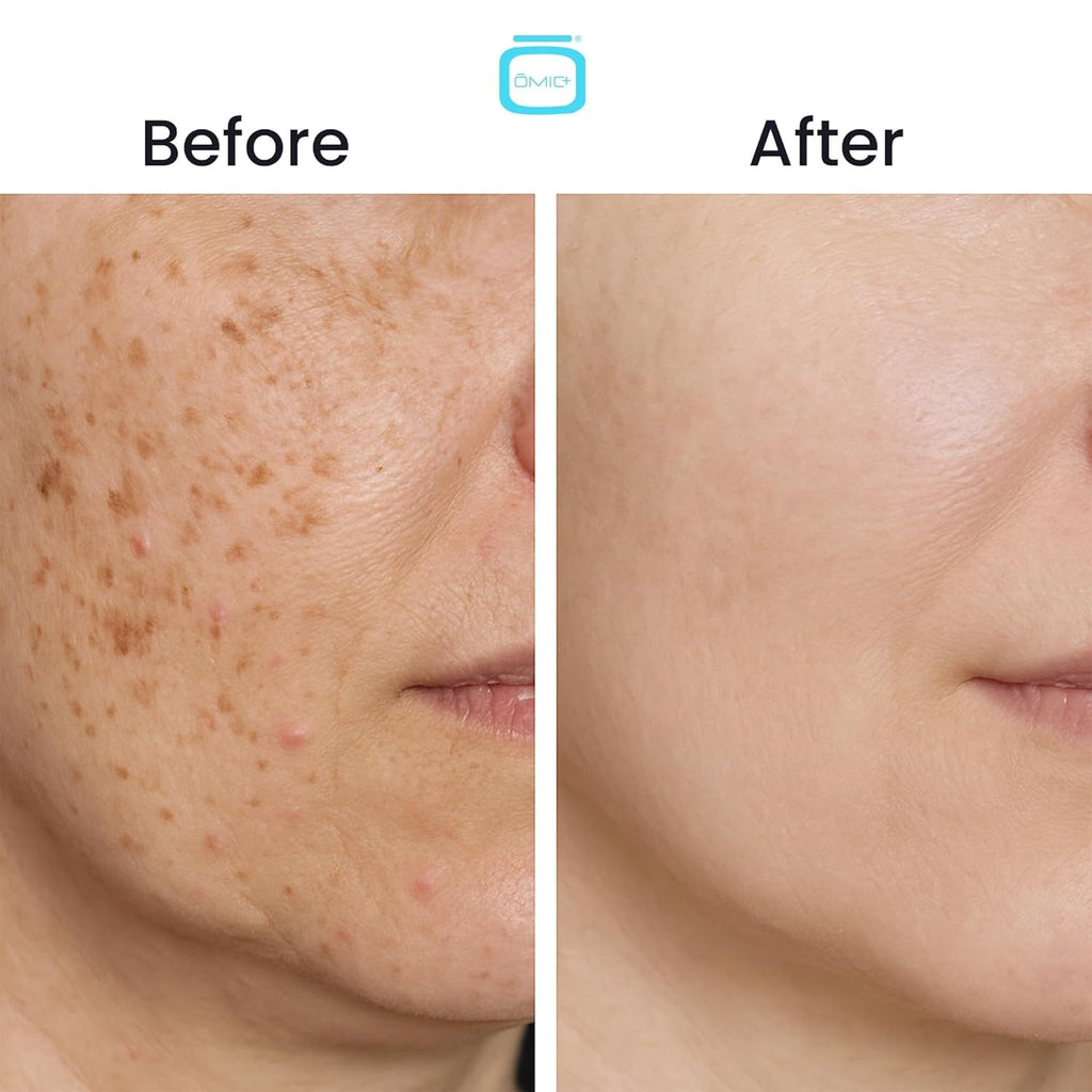 OMIC+ Skincare 7.5% Cysteamine Cream – Brightening & Even Tone, Lightweight Triple Complex