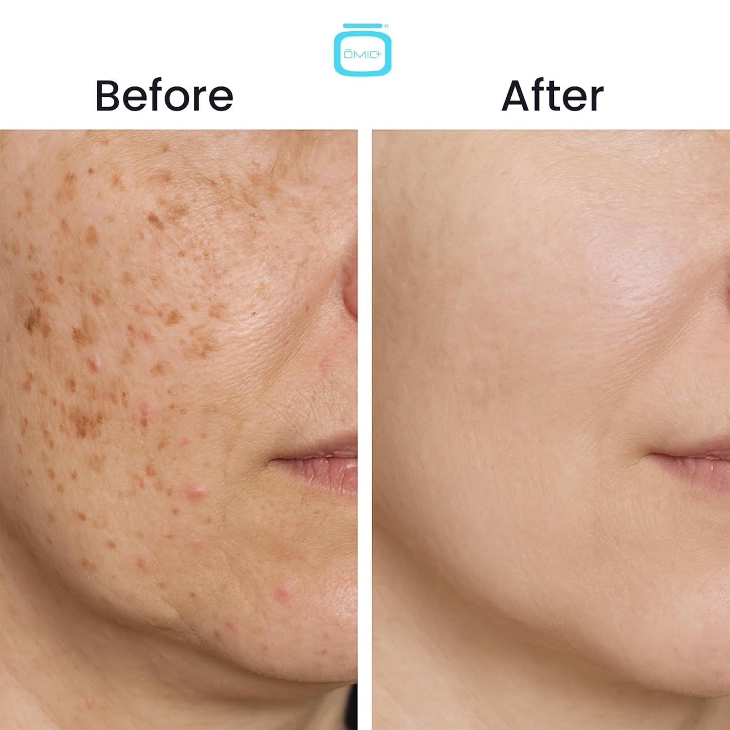 OMIC+ Skincare 7.5% Cysteamine Cream – Brightening & Even Tone, Lightweight Triple Complex