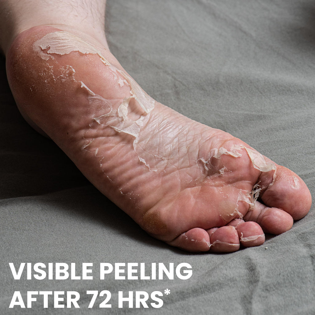 One's Own Korean Foot Peel Mask – Exfoliating Foot Mask for Dry Feet | 2 Pairs